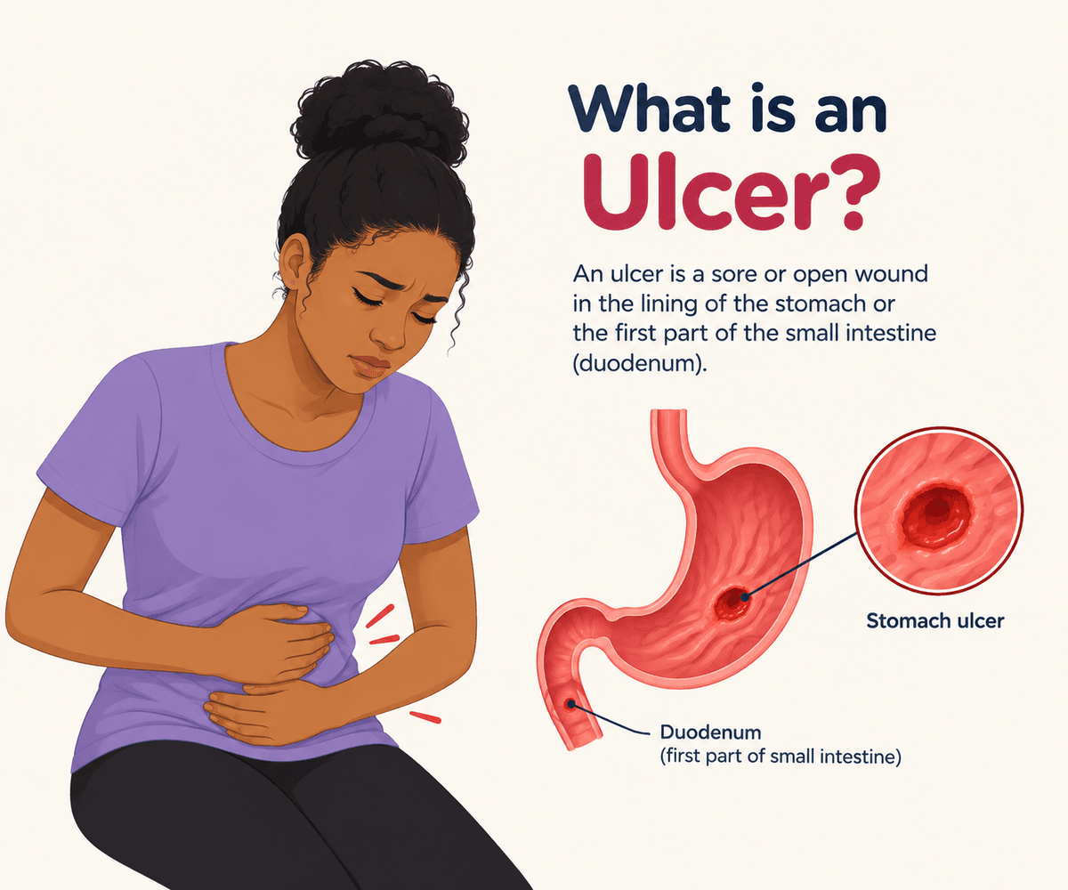 ULCER AWARENESS SERIES DAY 1 : IS EVERY STOMACH PAIN AN ULCER?